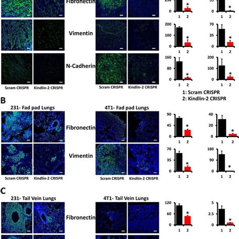 Loss Of Kindlin 2 Inhibits Invadopodia Formation And Degradation Of