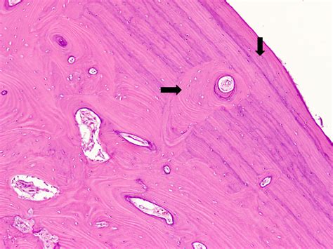 Bone Histology