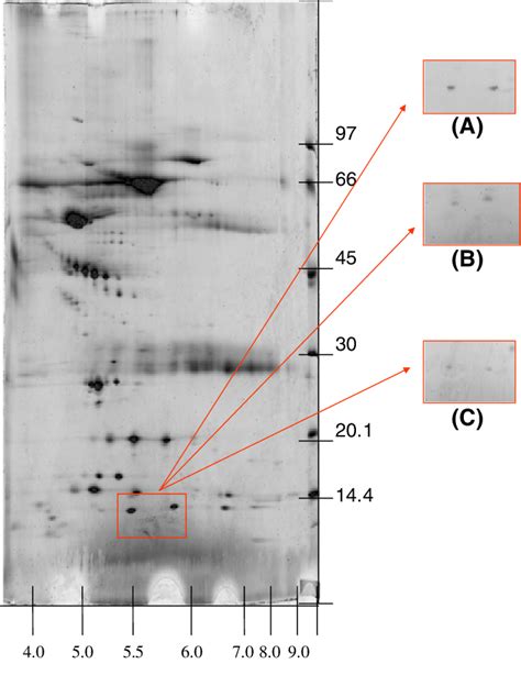 Two Dimensional Gel Electrophoresis 2 De Electrophotogram Of Serum Of Download Scientific