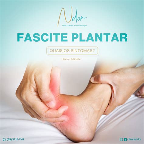 Você sabe quais são os sintomas da fascite plantar Ndor Clínica de