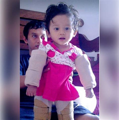 Patients are debating the latest advice from the famous dokter bob 22