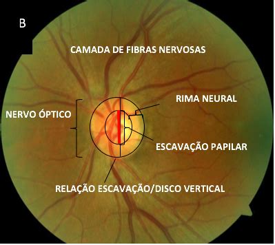 Introduzir 37 Imagem O Que Rima Fundo Br Thptnganamst Edu Vn