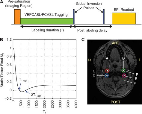 Cerebral Blood Flow Quantification Using Vessel Encoded Arterial Spin