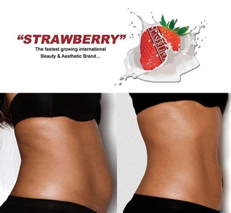 Strawberry Laser Huntsville Al Madison Surgical Associates