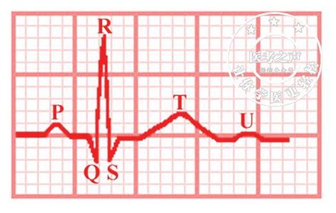 千呼萬喚，心電圖下篇來啦心梗、心肌缺血心電圖這麼看！ 每日頭條