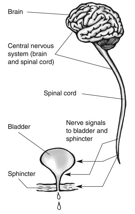 Neurogenic Bladder