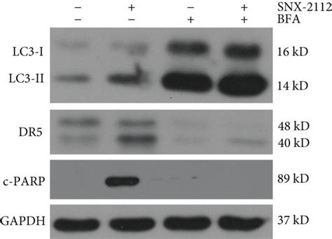 DR5 Expression Is Regulated By SNX 2112 Induced Autophagy A B HeLa