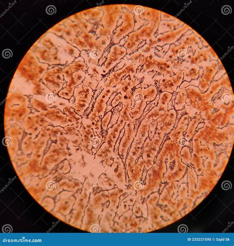 Microscopic Image Of A Human Tissue Stain Slide Histology Stain Stock