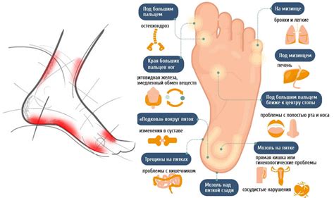 Почему болят стопы ног и пятки чем лечить в домашних условиях фото