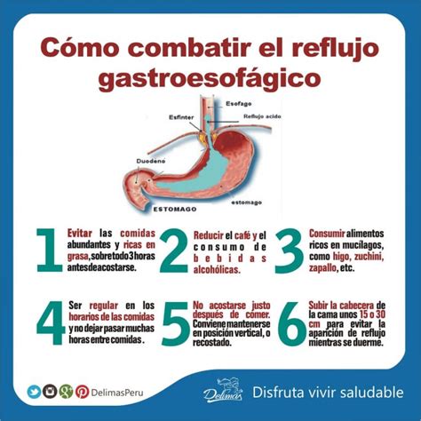 Tratamiento Para El Reflujo 6 Claves Para Combatirlo Blog Vive Sano