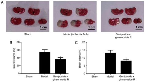 Protective Effects Of Geniposide And Ginsenoside Rg1 Combination