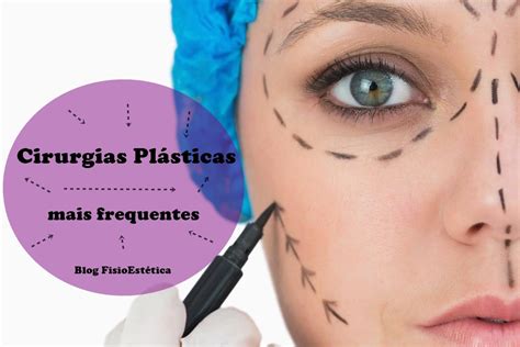 Cirurgias Plásticas mais frequentes FisioEstética