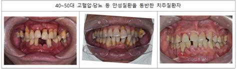 年1000만 명 진료 받는 이 질환 50대 가장 많다 당신의 건강가이드 헬스조선