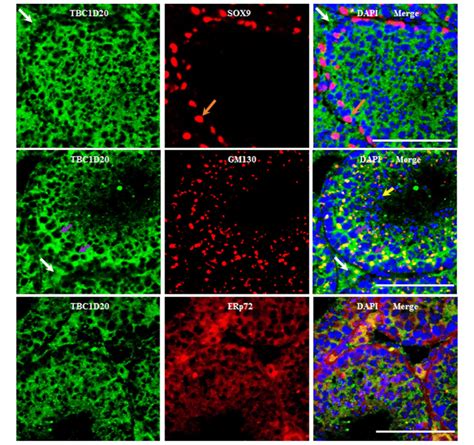 Subcellular Localisation Of Tbc1d20 In Mouse Testis Immunofluorescence