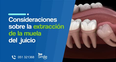 Consideraciones Sobre La Extracci N De La Muela Del Juicio