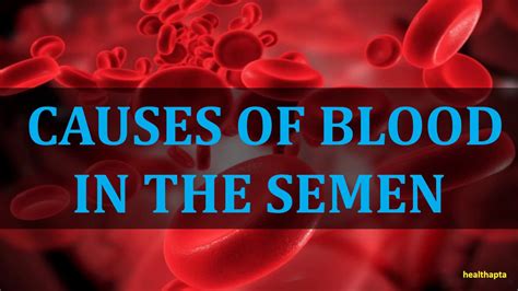 Causes Of Blood In The Semen Youtube