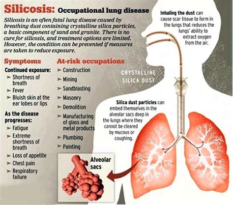 Silicosis