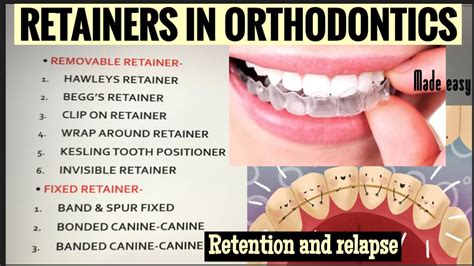 Retainers In Orthodontics Ii Removable And Fixed Ii Retention And Relapse Youtube