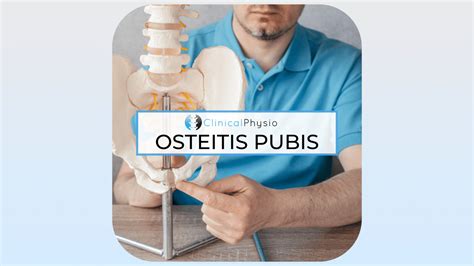 Osteitis Pubis Clinical Physio Membership