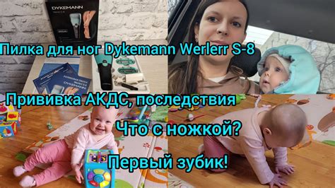 ПИЛКА ДЛЯ НОГ DYKEMANN WERLERR S-8/ ПРИВИВКА АКДС/ПОСЛЕДСТВИЯ/ ЧТО С ...