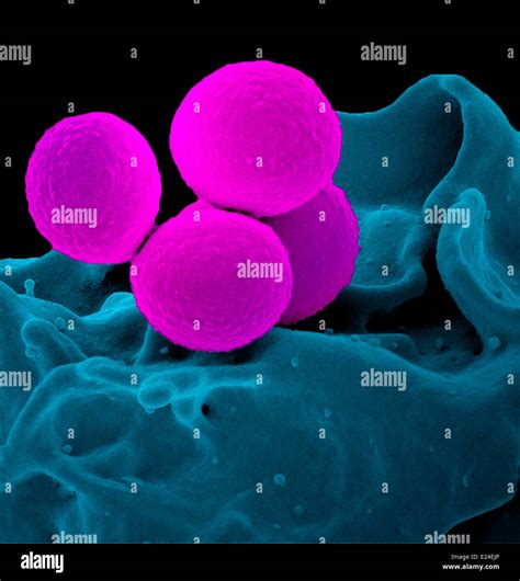 Scanning Electron Micrograph Of A Human Neutrophil Ingesting Mrsa Stock