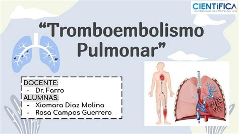 Tromboembolismo Pulmonar Xiomara Diaz Udocz