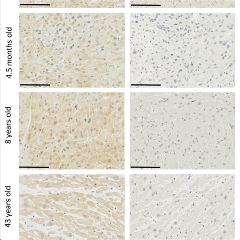 Relative MRNA Expression Of Agrin And Associated Proteins In Human