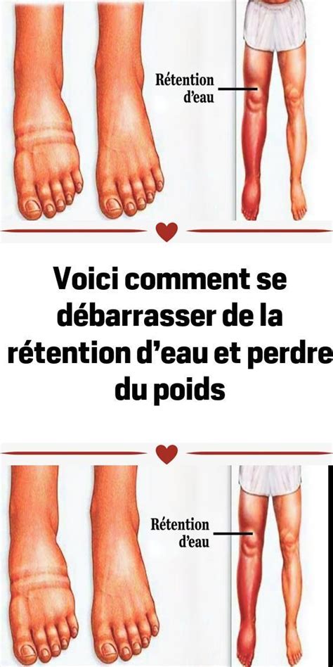 Pin on Astuces et Santé