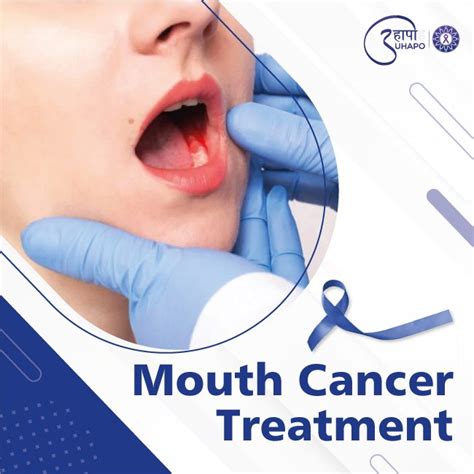 Mouth Cancer Treatment In Mumbai Nera Thane India Uhapo