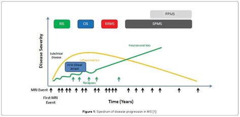 Ms Progression Chart