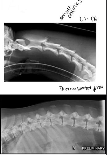 Diagnostic Imaging: Spine Flashcards | Quizlet