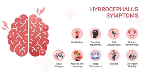 What Is Hydrocephalus Lone Star Neurology