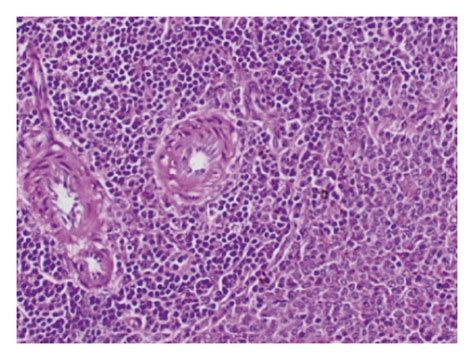 Photomicrographs Of H And E Stained Sections Of Spleen Of The Different