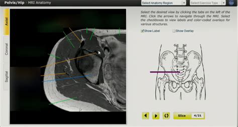 Hip MRI: axial slice #2 Diagram | Quizlet