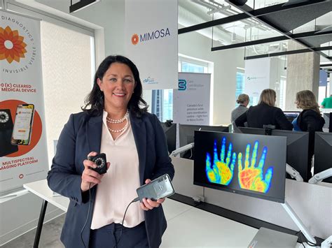 MIMOSA Diagnostics’ portable imaging device is saving limbs and lives