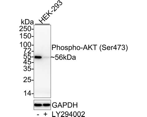 Phospho Akt S473 Recombinant Rabbit Monoclonal Antibody Psh04 44