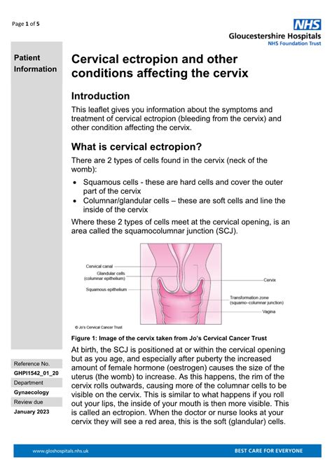 Cervical Ectropion and Other Conditions Affecting the Cervix - DocsLib