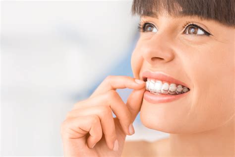 What To Expect With Clear Aligner Therapy South West Rocks Dentist