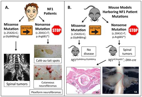 Genetics Of Mice And Men Nf1 Patient Specific Mouse Models Offer Hope Atlas Of Science