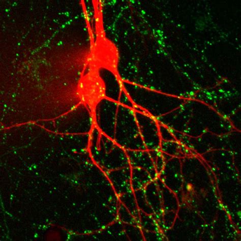 Neuronal Probes And Tools Biotium