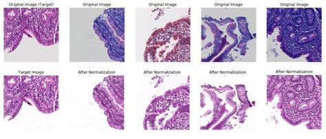 Stain Normalization On Patches Images In The Top Row Highlight The