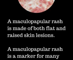 Maculopapular Rash: Symptoms, Causes and Treatment