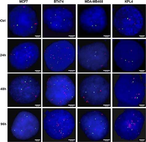 Full Article ZNF217 Gene Copy Number As A Marker Of Response To