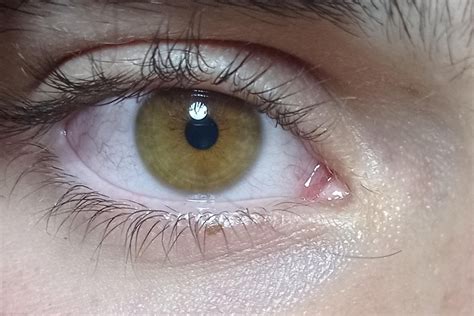 Took A Photo In The Morning And Before Going To Sleep Does Anyone Know