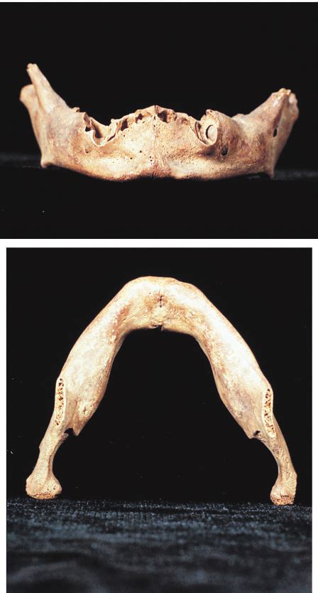 Mandible of recent 2–3 year old Homo sapiens (American Museum of ...