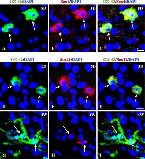 A I Differential Immunoexpression Of Sox And Sox In Amc And Rmc