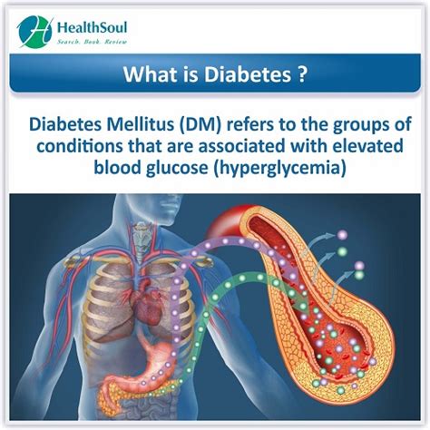 Diabetes Mellitus Causes And Treatment Healthsoul