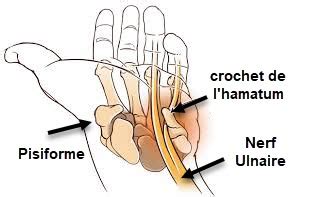 Syndrome Du Canal De Guyon Causes Sympt Mes Et Traitements Osteomag