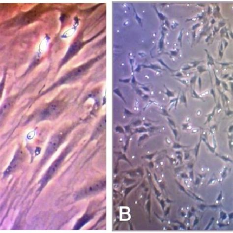 The Culture Of Mesenchymal Stem Cells Mscs A The Mscs Population Download Scientific