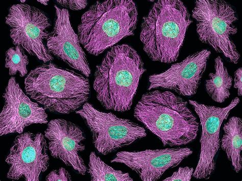 Life Cell Imaging Techniques Are Increasingly Being Used By Cell Biologists To Better Understand